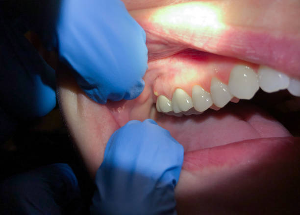 Best Emergency TMJ Treatment in Sulphur Springs, TX
